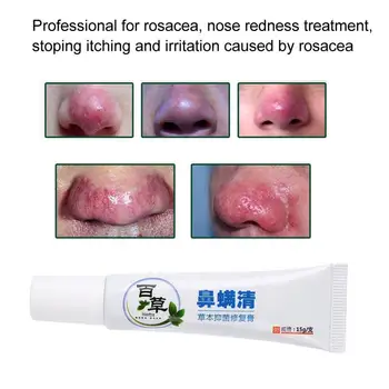 15 g Rosacea Liečba Krém Nos Začervenanie Odstránenie Čistenie Antibakteriálne Gél na Starostlivosť o Pleť