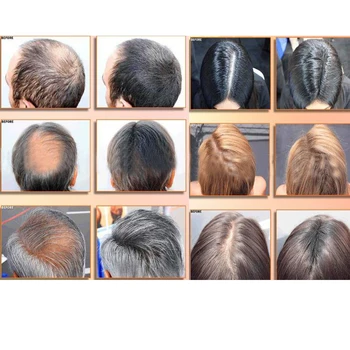 BOQIAN Profesionálne Zázvor Anti Hair Loss Shampoo 300 ml Výživný Prírodný Rast Vlasov Rýchlo Husté Hrubšie Proti vypadávaniu Vlasov Produkt